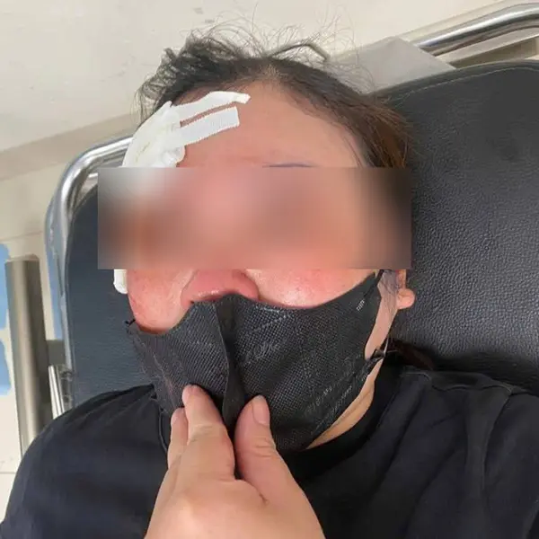 Hà Nội: Công an vào cuộc xác minh vụ người phụ nữ bị tài xế ô tô dùng dùi cui đánh vào đầu