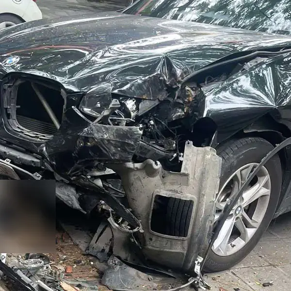 Nữ sinh Hà Nội bị đứt lìa 1 chân sau va chạm với xe sang BMW